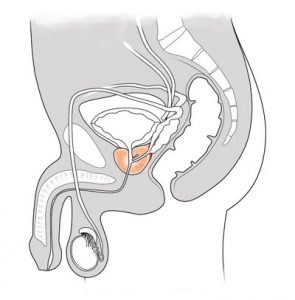 Diagram of men's prostate