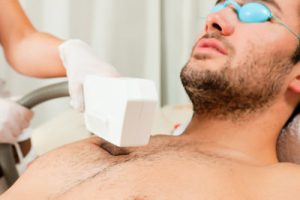 Man receiving Manscape treatment hair removal